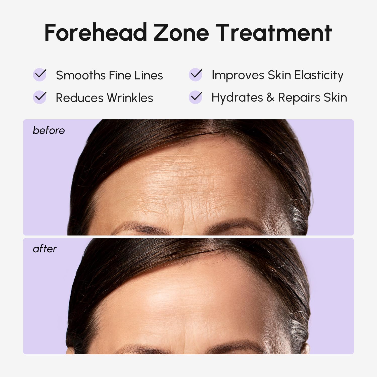 MAREE collagen-retinol-hyaluronic-acid formula patch for targeted anti-wrinkle care.