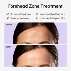 MAREE collagen-retinol-hyaluronic-acid formula patch for targeted anti-wrinkle care.