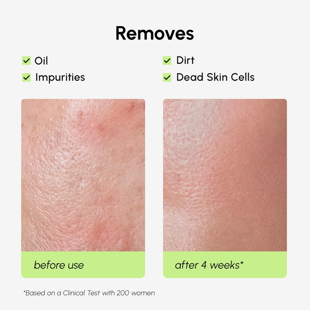 MAREE Exfoliating Toner texture on skin shows gentle, fast-absorbing application.