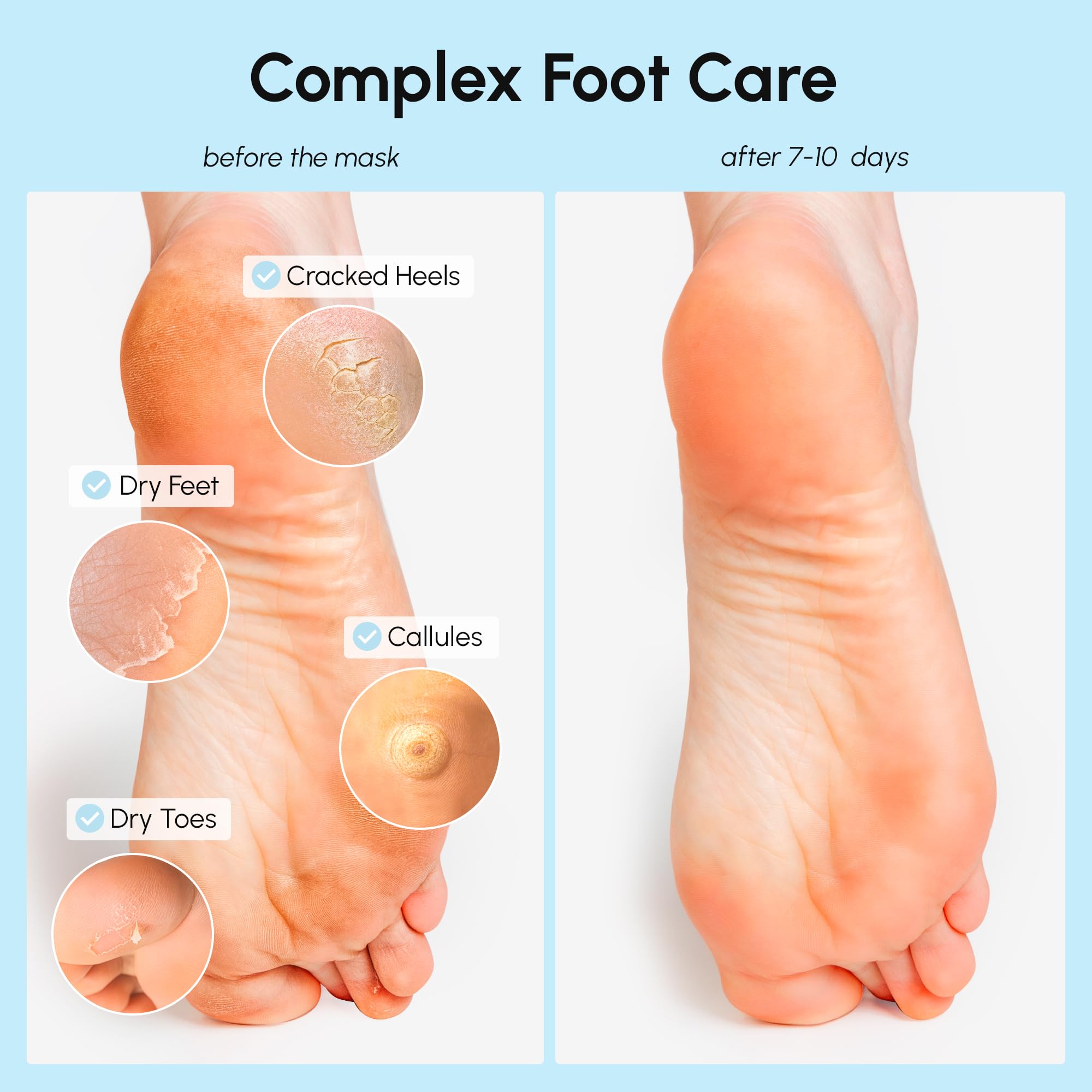 MAREE Foot Peeling Mask application scene shows gentle exfoliation.
