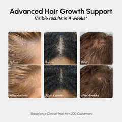 Rosemary oil bottle highlighting scalp conditioning benefits.