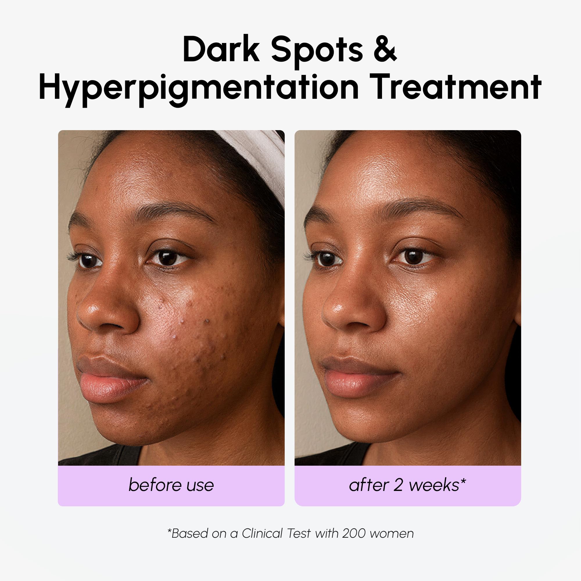 MAREE body dark spots correction closeup illustrates versatile use on larger areas.