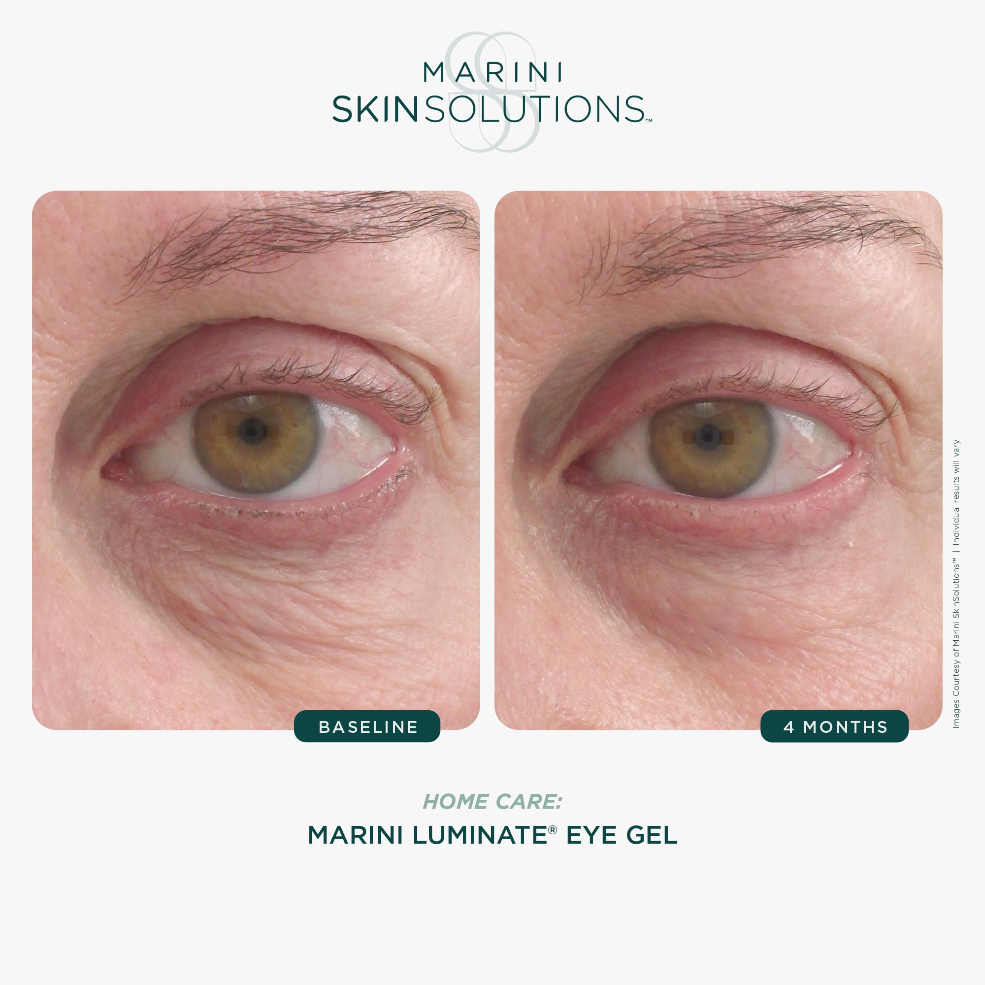 Marini SkinSolutions Luminate Eye Gel under-eye application scene