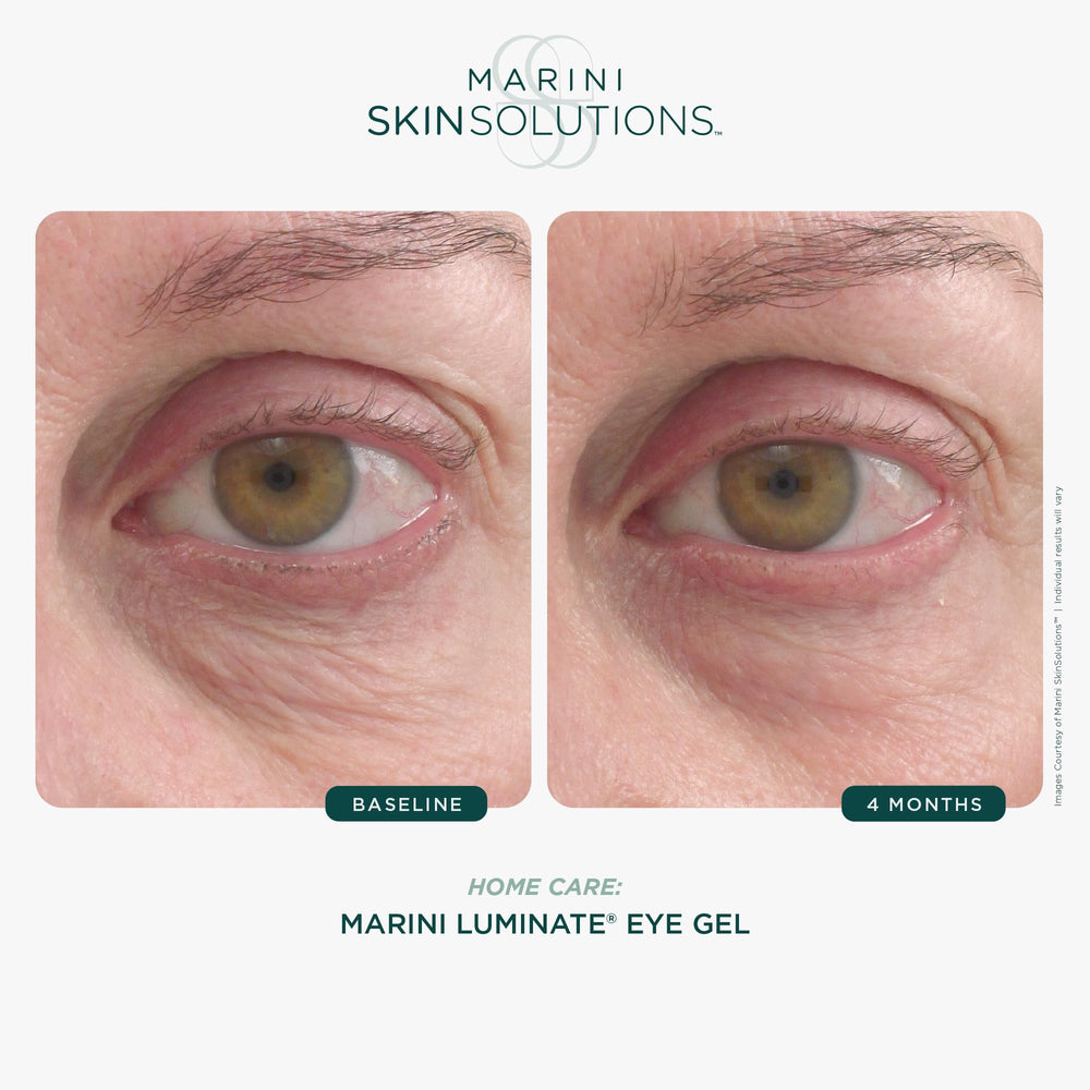 Marini SkinSolutions Luminate Eye Gel under-eye application scene