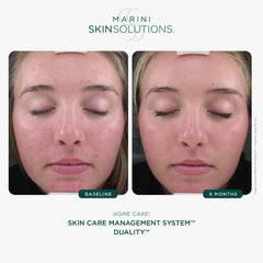 Marini SkinSolutions Duality cream texture closeup shows lightweight formula for quick absorption