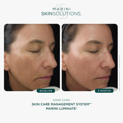 Marini SkinSolutions Luminate dispense-cap, easy nightly use
