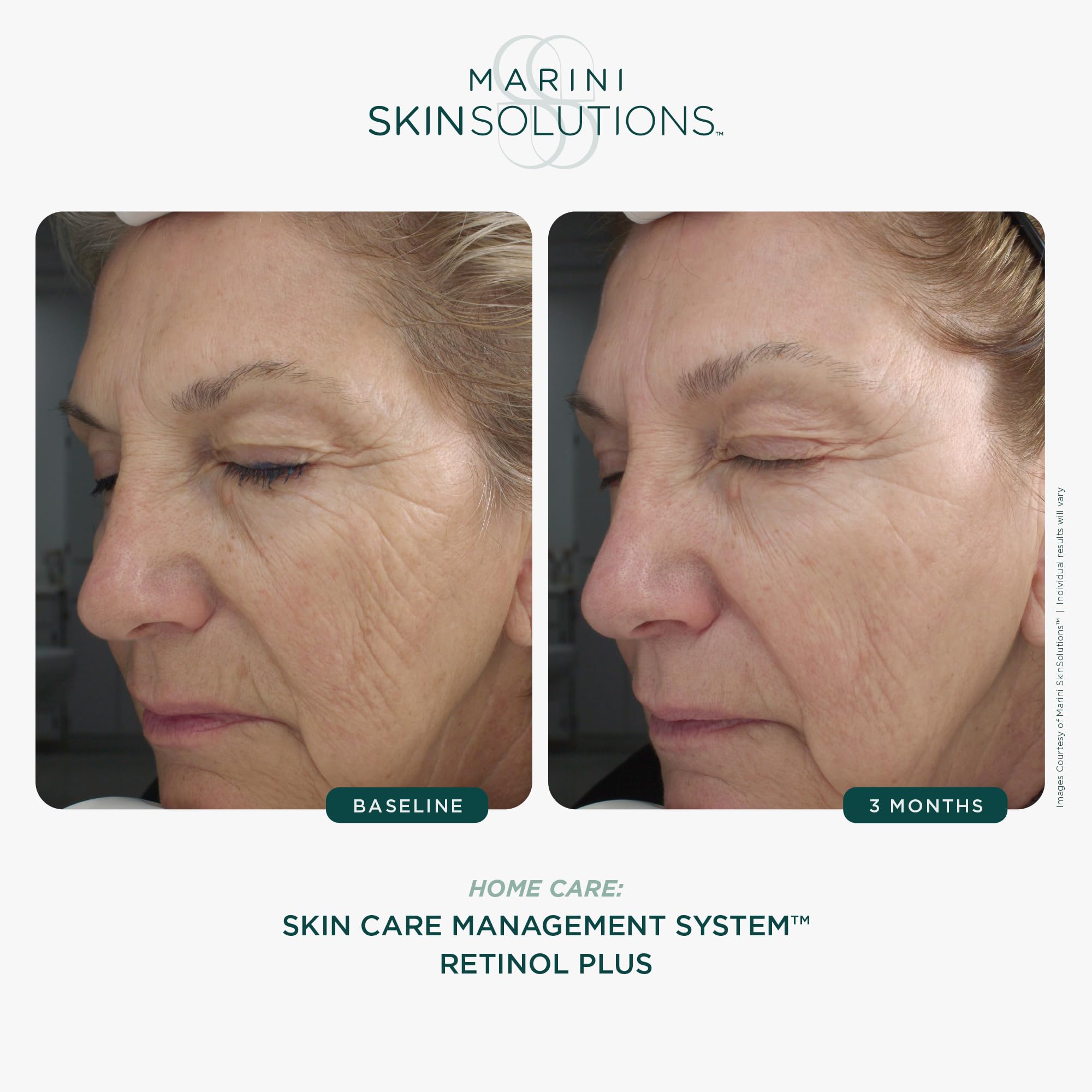 Marini SkinSolutions Retinol Plus bottle highlighting ingredients green tea for soothing antioxidants.