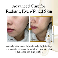 Fermented Mastic in Mastina Serum Roller improves absorption for delicate eye-area use.