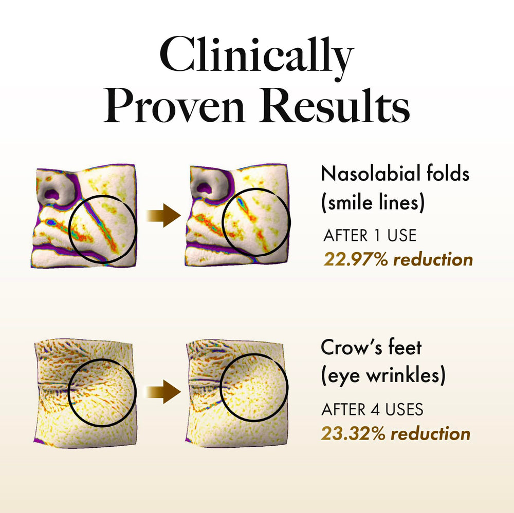 Mastina Mastic Serum Roller works overnight to support clearer, more radiant skin by morning.