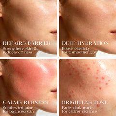 MATRÚM formula calms redness on sensitive skin during use.