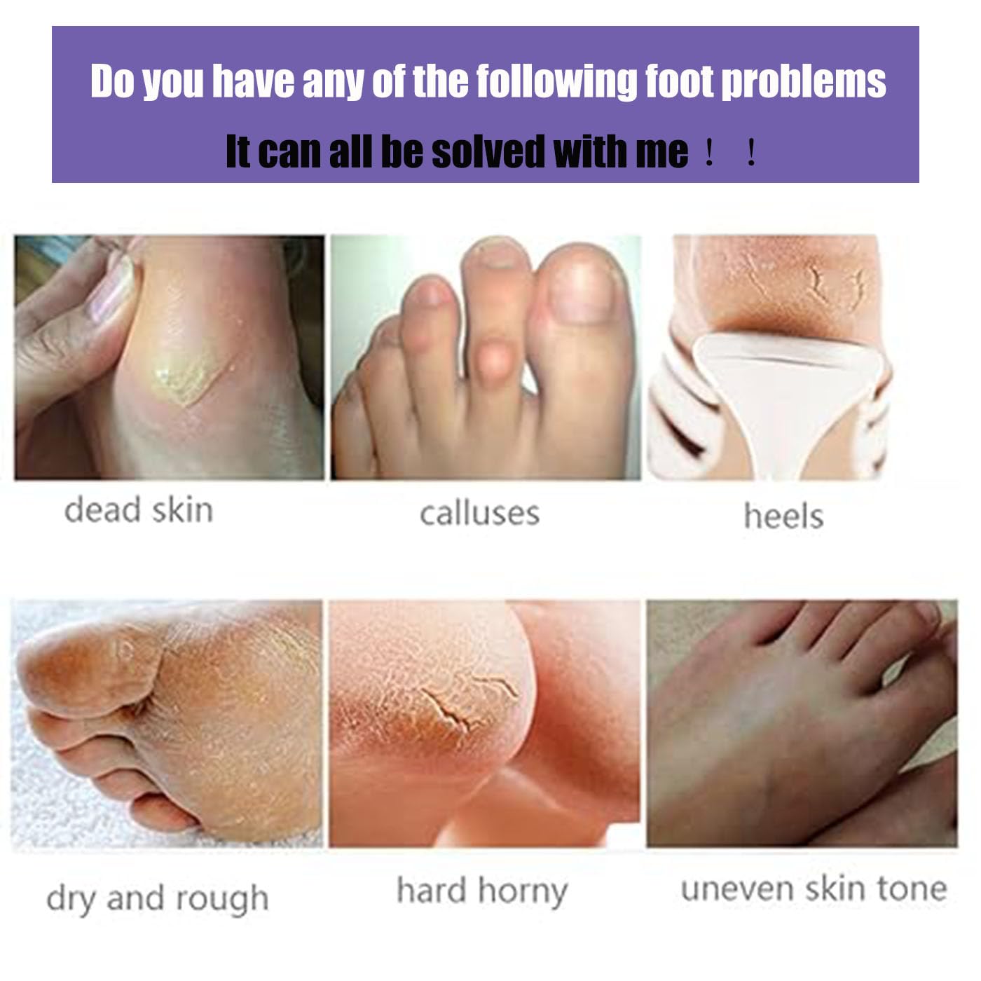 Mckkymi foot mask applied on feet demonstrating easy at-home spa use