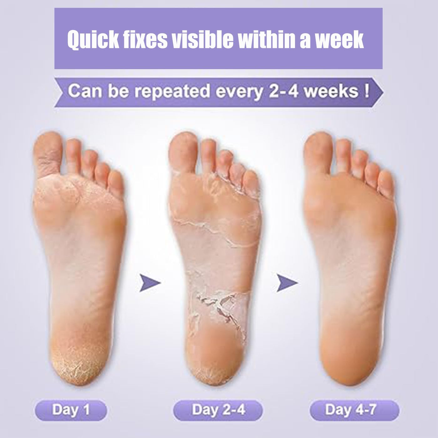 Mckkymi bootie next to ruler showing size and fit for most foot sizes