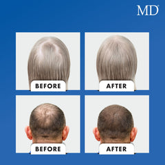 MD Nutri Hair capsules inside bottle convey consistent daily intake
