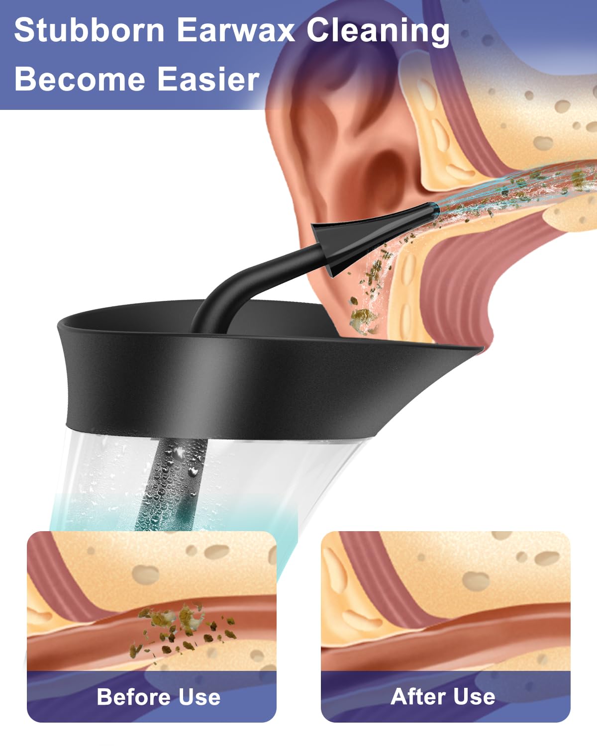 Mecmic ear cleaner in ergonomic one-hand design for easy handling