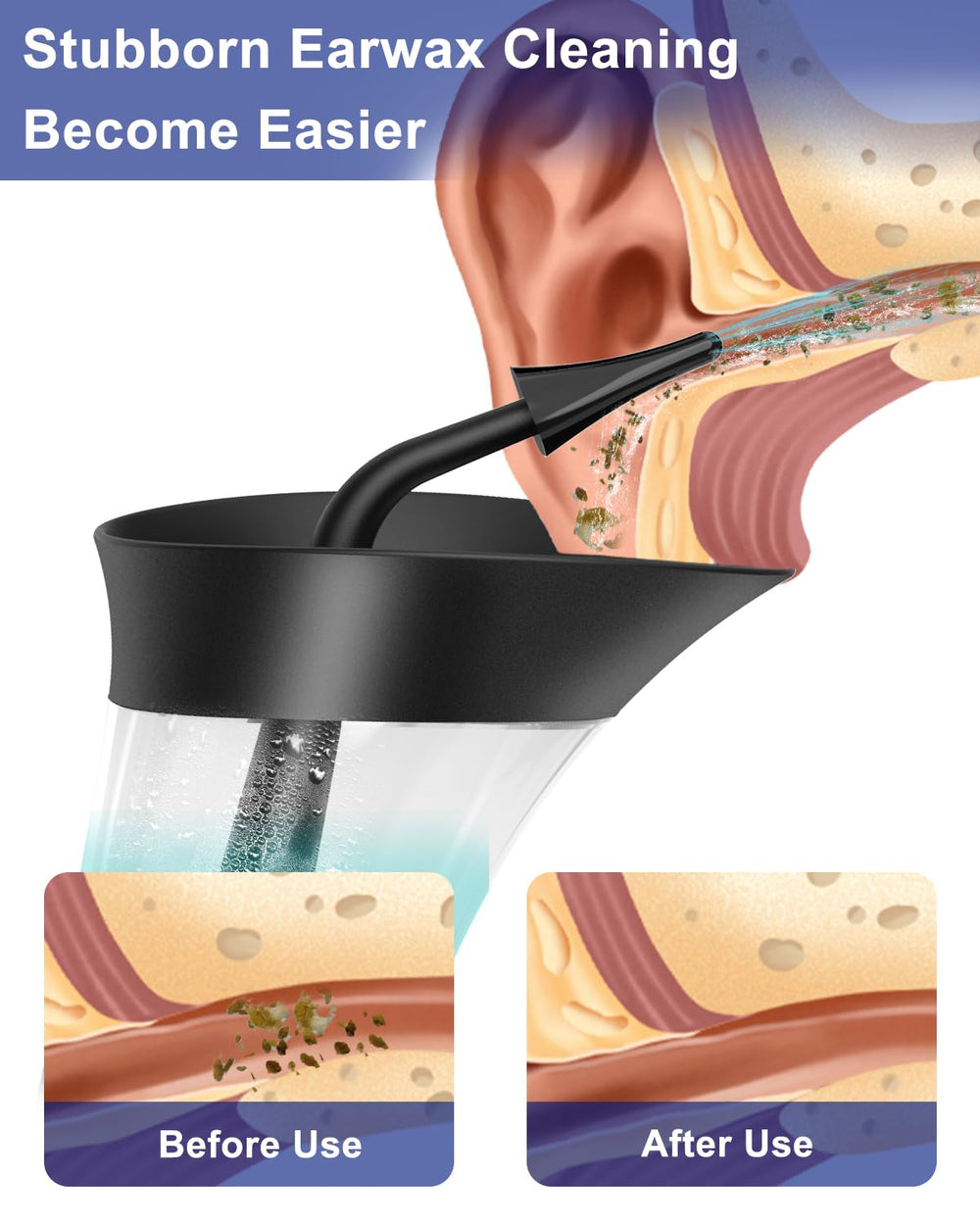 Mecmic ear cleaner in ergonomic one-hand design for easy handling