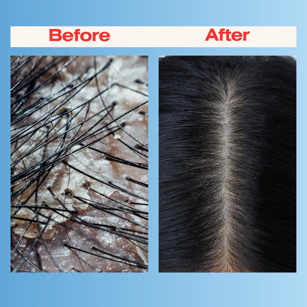 Mediceuticals Therapro application scene shows step-by-step use at sink