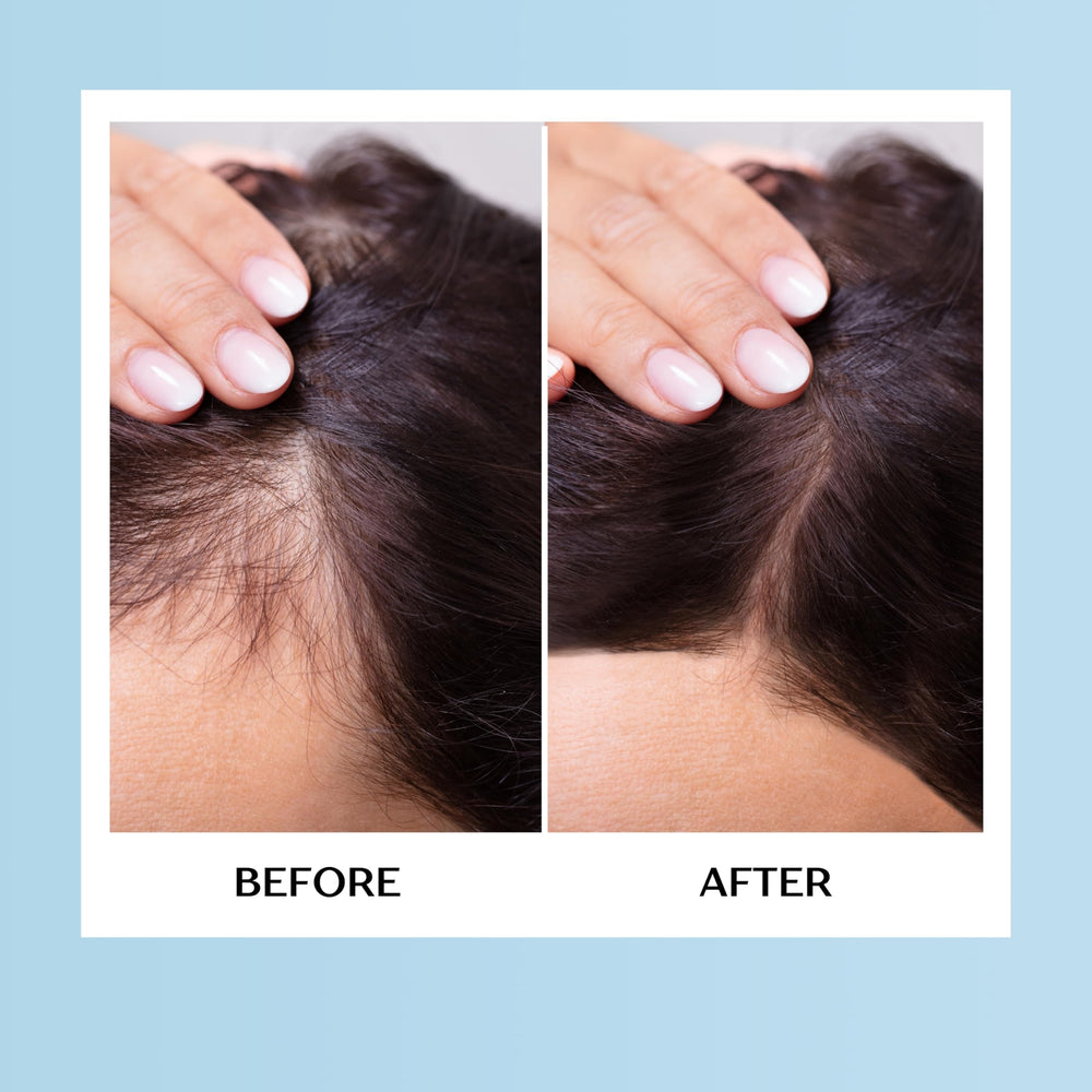 Mediceuticals Therapro HairGain lifestyle scene during daily routine