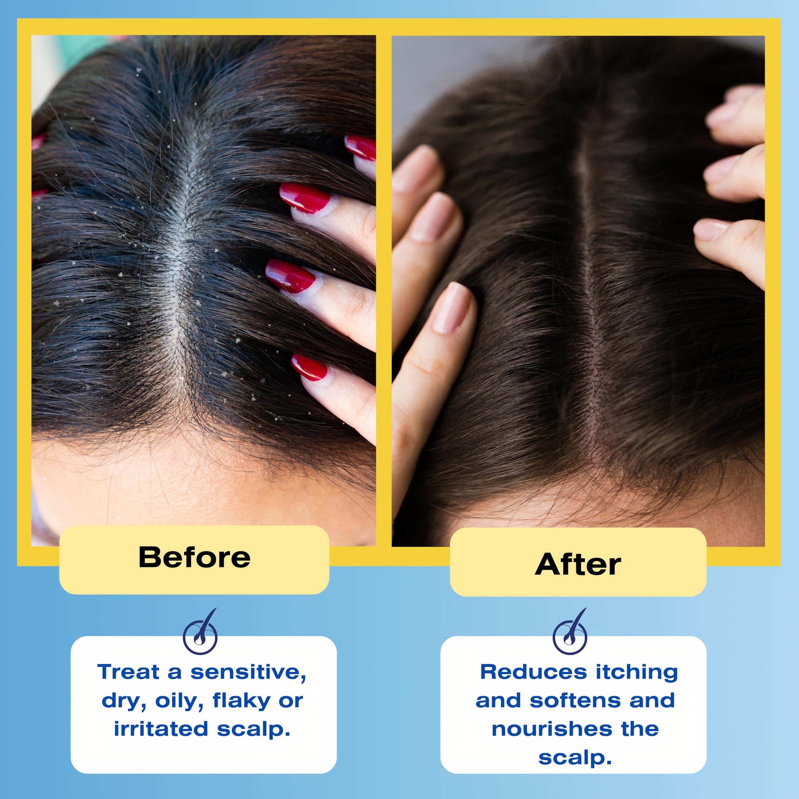 Foamy lather around scalp after Therapro rinse, indicating cleansing action.