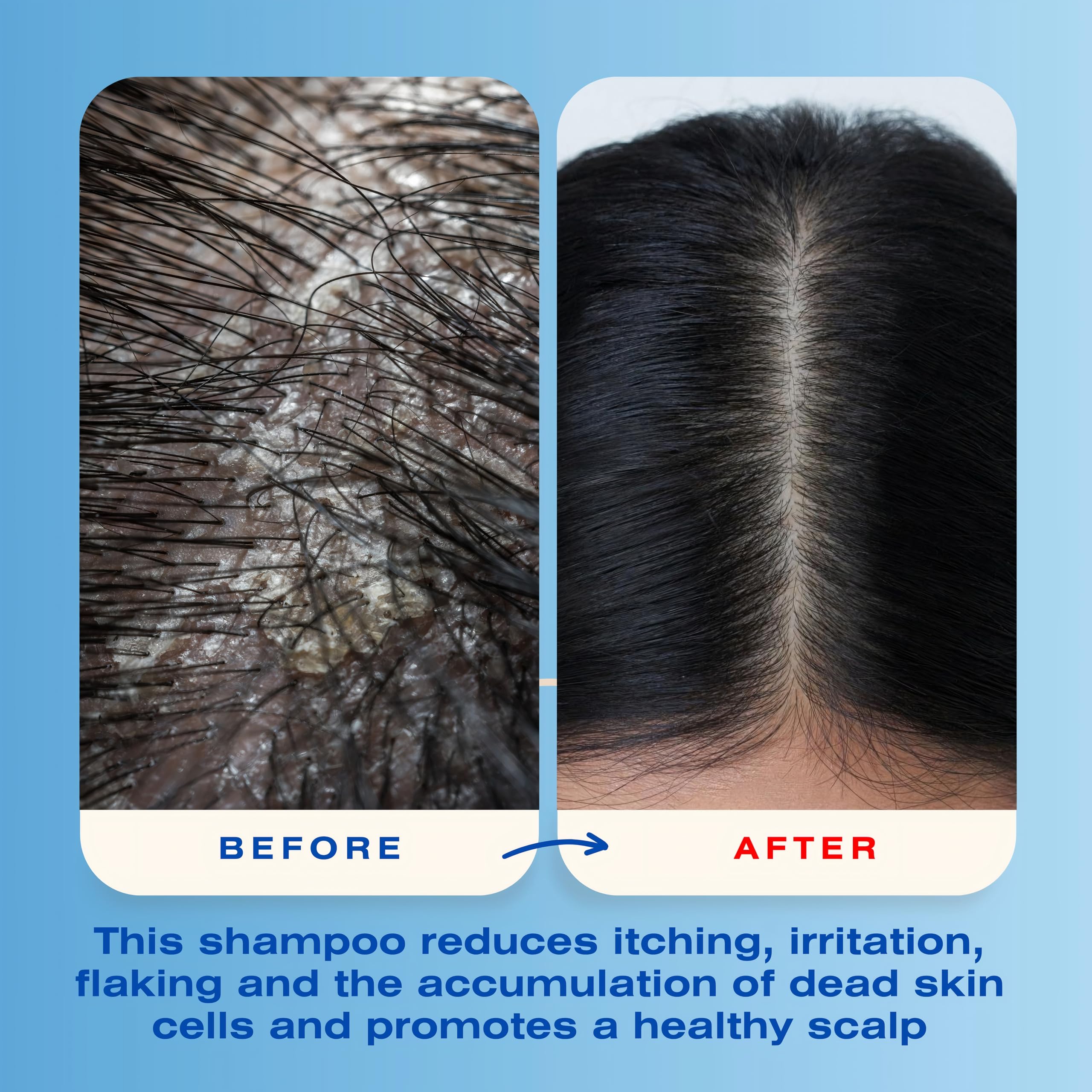 Mediceuticals X-Folate Shampoo unisex packaging appeals to all hair types.
