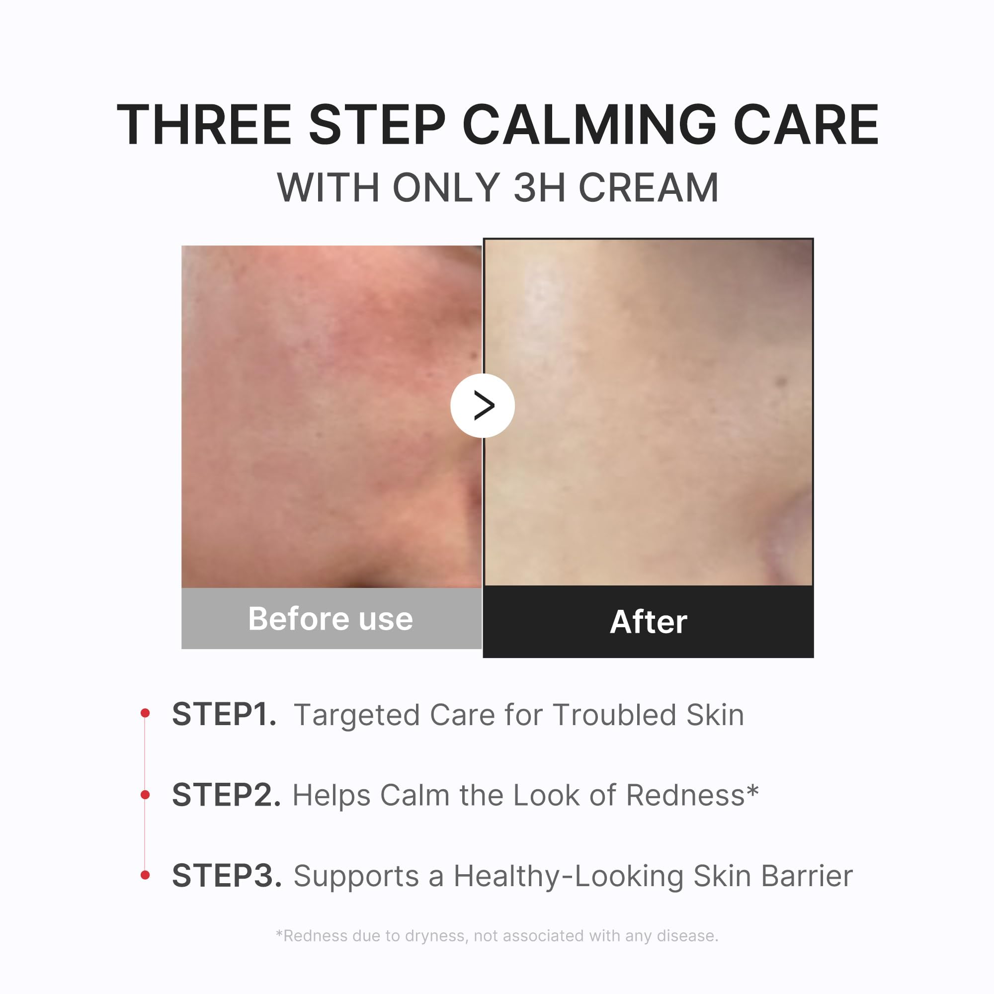 Medicube 3H Cream featuring Centella Asiatica for calming care