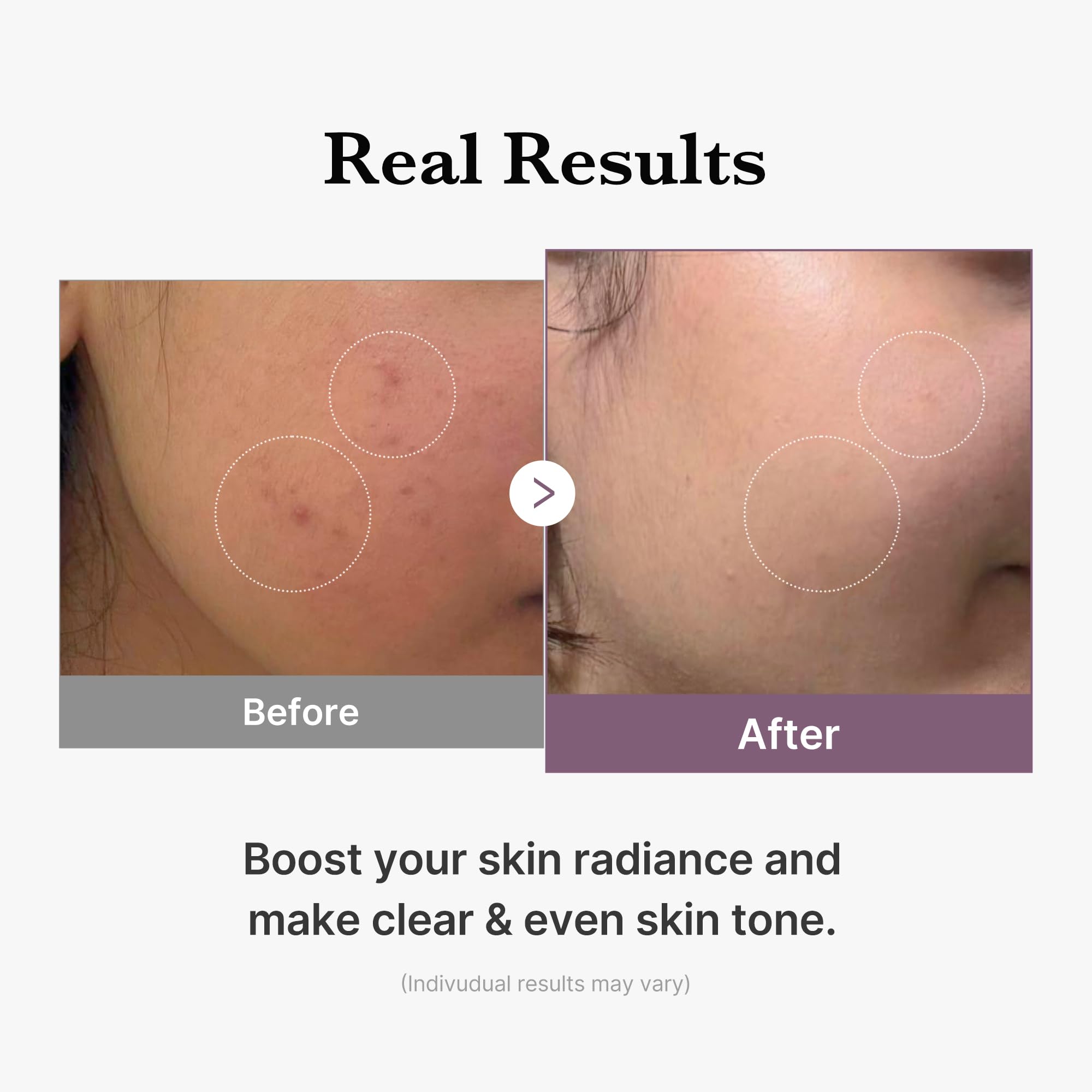 Radiance shot featuring Medicube Age-R Glutathione Glow Milky Toner on clean skin.