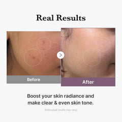 Radiance shot featuring Medicube Age-R Glutathione Glow Milky Toner on clean skin.