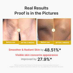 Medicube Body Peel Shot Turmeric ingredients and packaging highlight turmeric and ceramides.