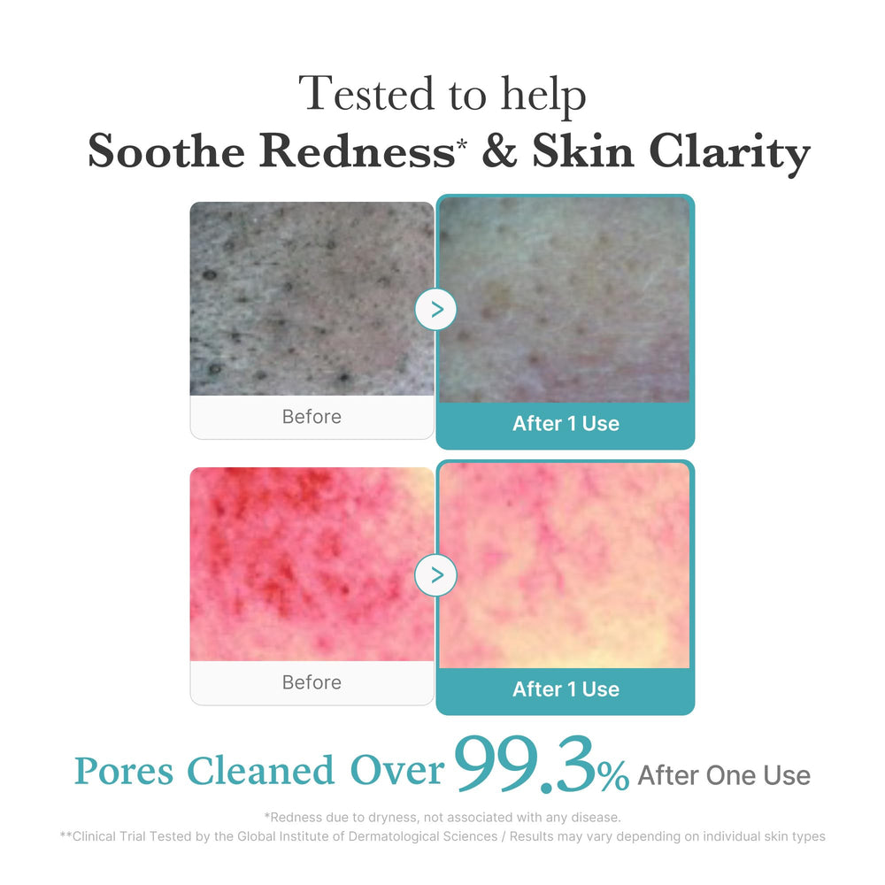 Medicube deep pore care formula with glycerin balances excess oil.