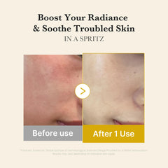 medicube Jelly Mist Serum Kojic Acid and Vitamin C for even tone.