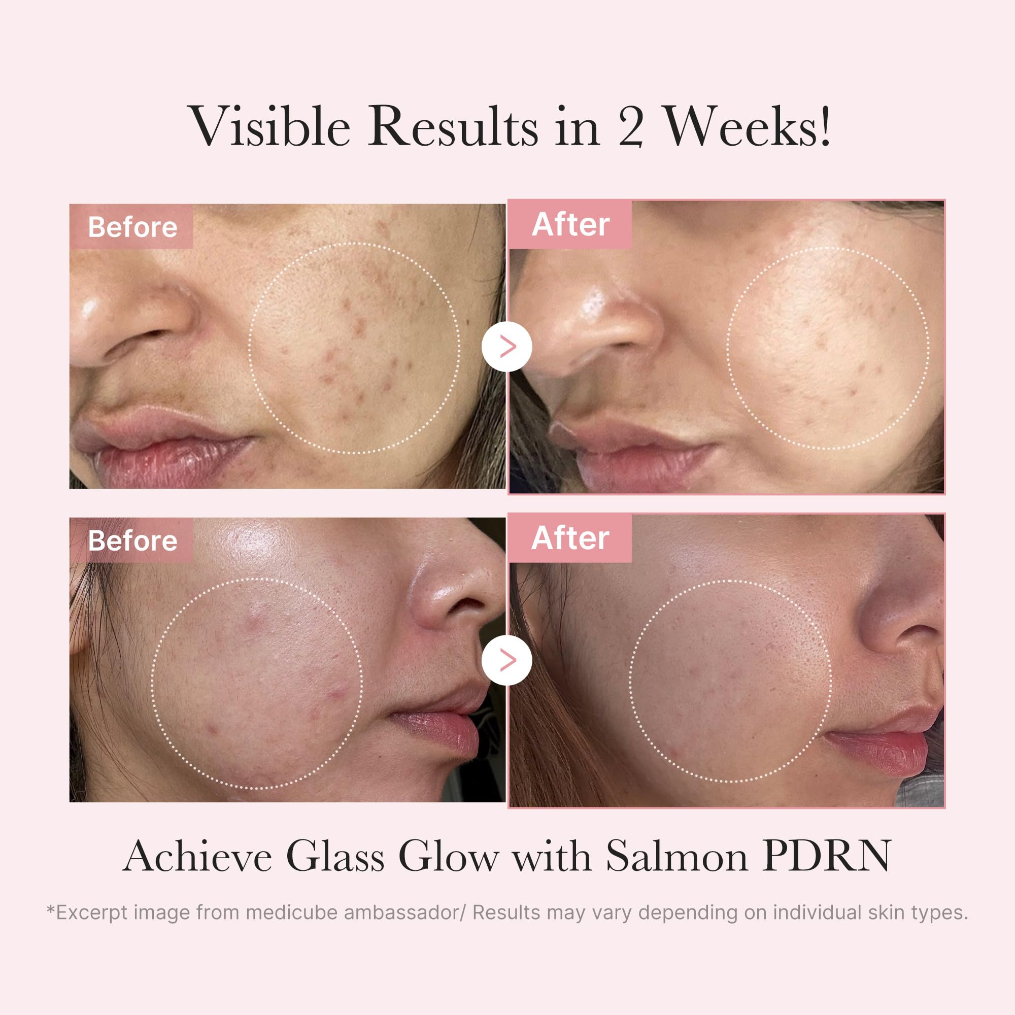 Medicube PDRN ampoule delivering concentrated hydration for revitalized skin.