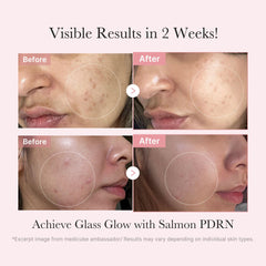 Medicube PDRN ampoule delivering concentrated hydration for revitalized skin.