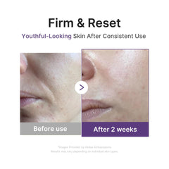 Medicube Retinol Boosting Serum texture swatch on skin showing smoothness
