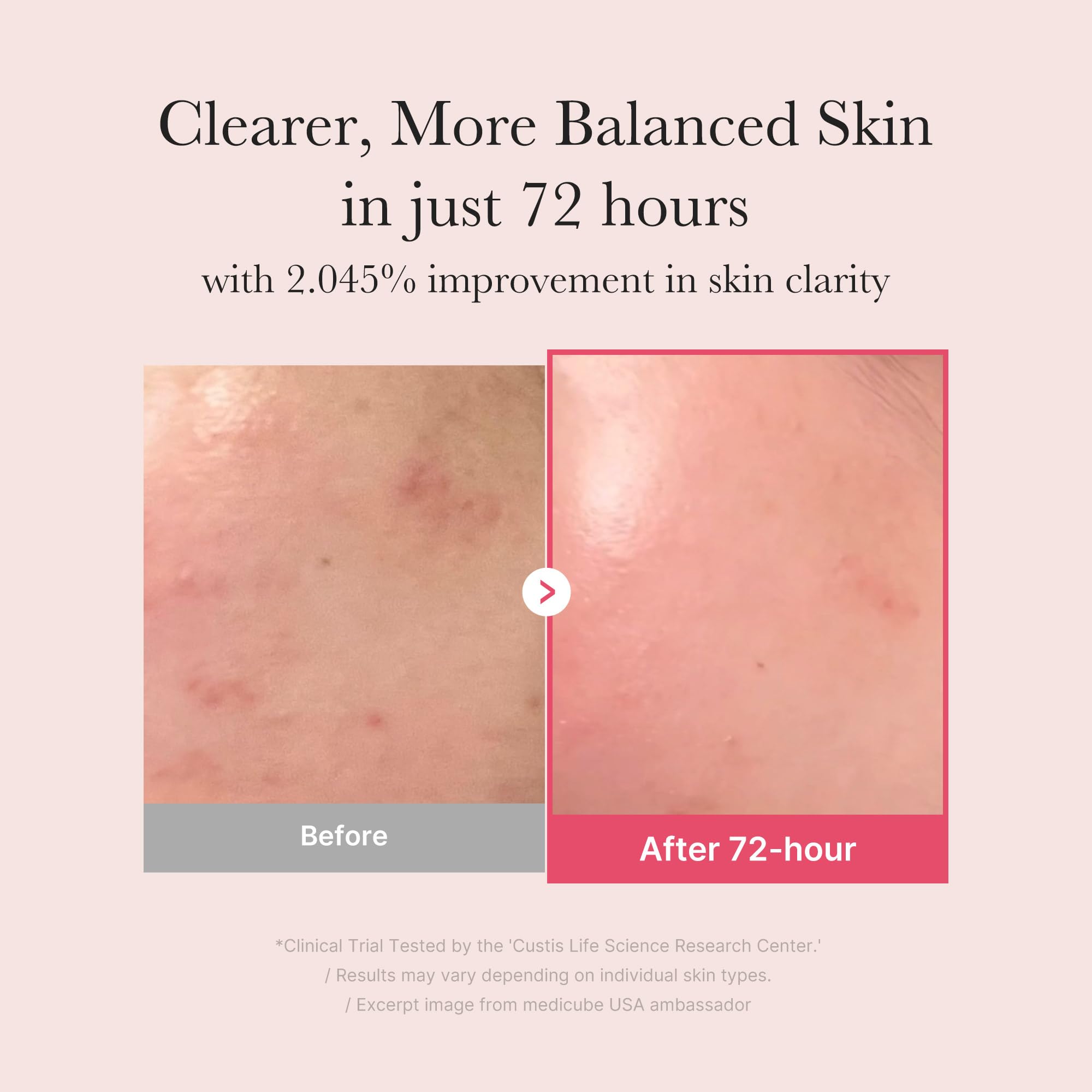 Medicube TXA+Niacinamide Glow Serum swatch on skin shows even tone and light texture