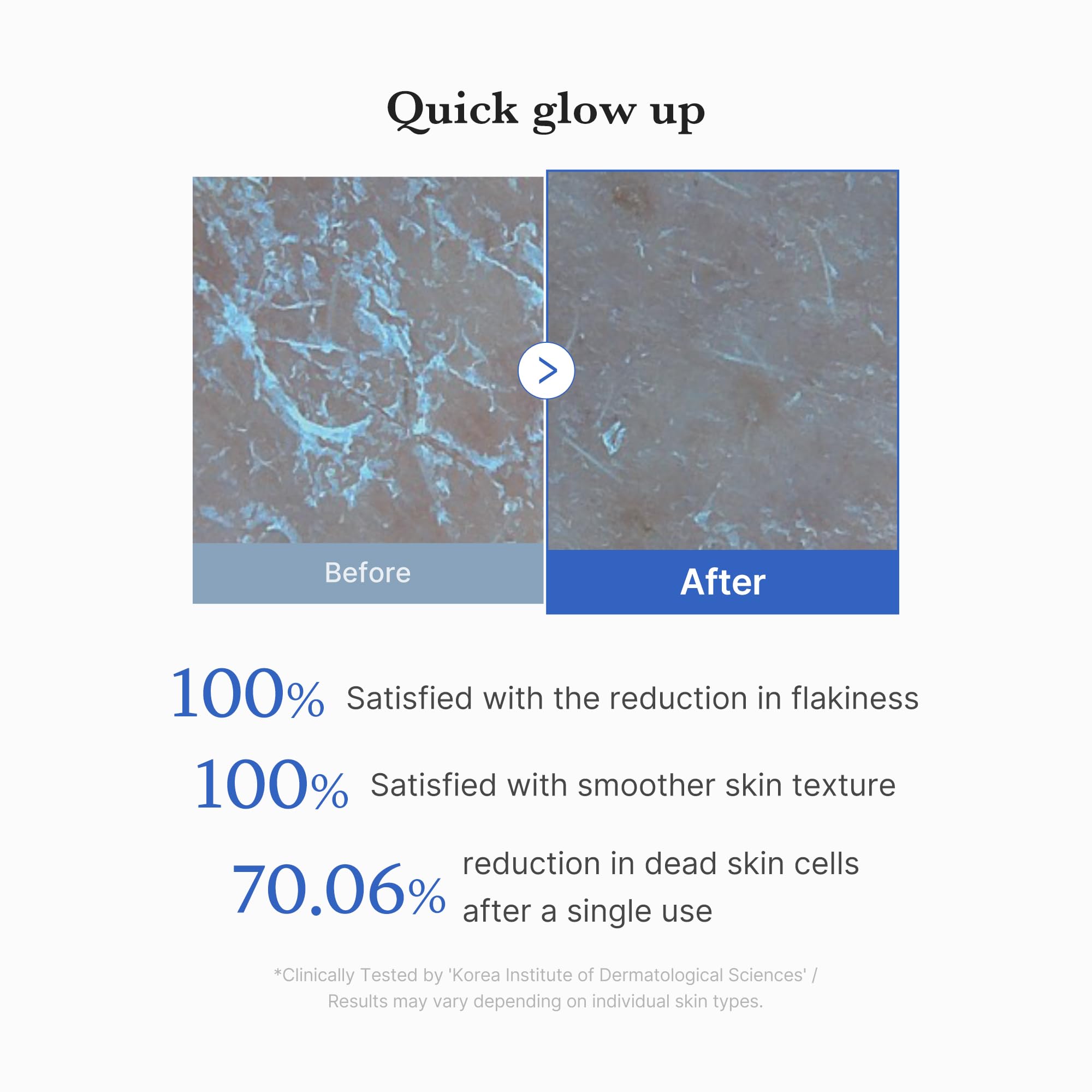 Medicube Zero Pore Peel Pads cotton-side smoothing close-up on skin texture