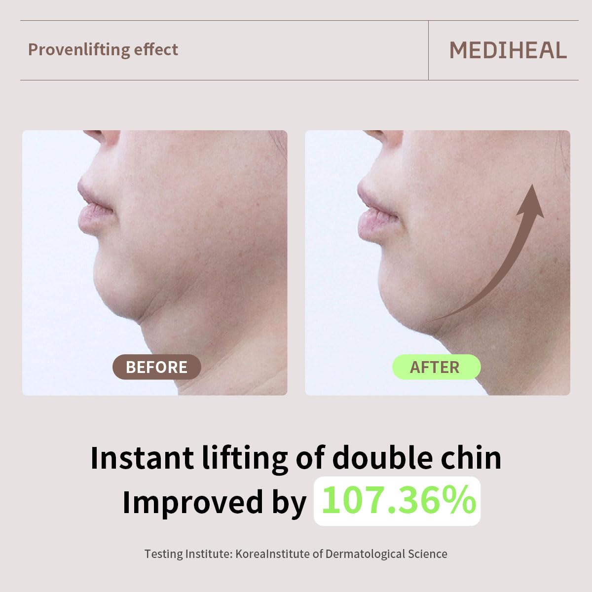 Mediheal Mild Formula is suitable for sensitive skin.