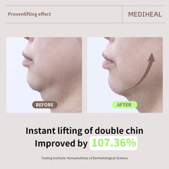 Mediheal Mild Formula is suitable for sensitive skin.