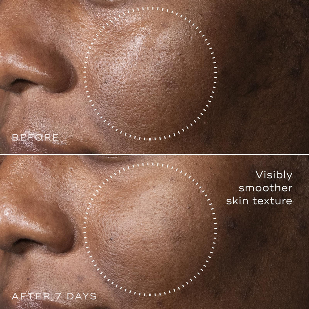 Medik8 C-Tetra Advanced hyaluronic acid glow detail highlights hydration potential.
