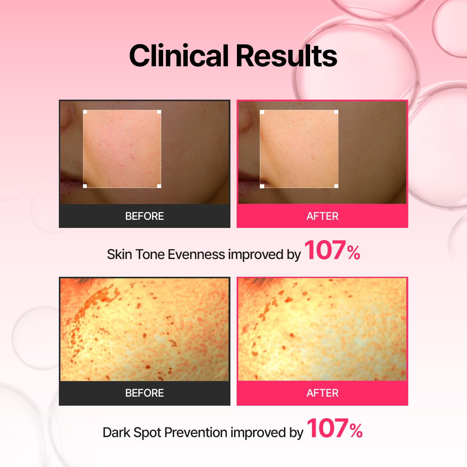 MEDITHERAPY Arbutin Serum application on face for even tone.
