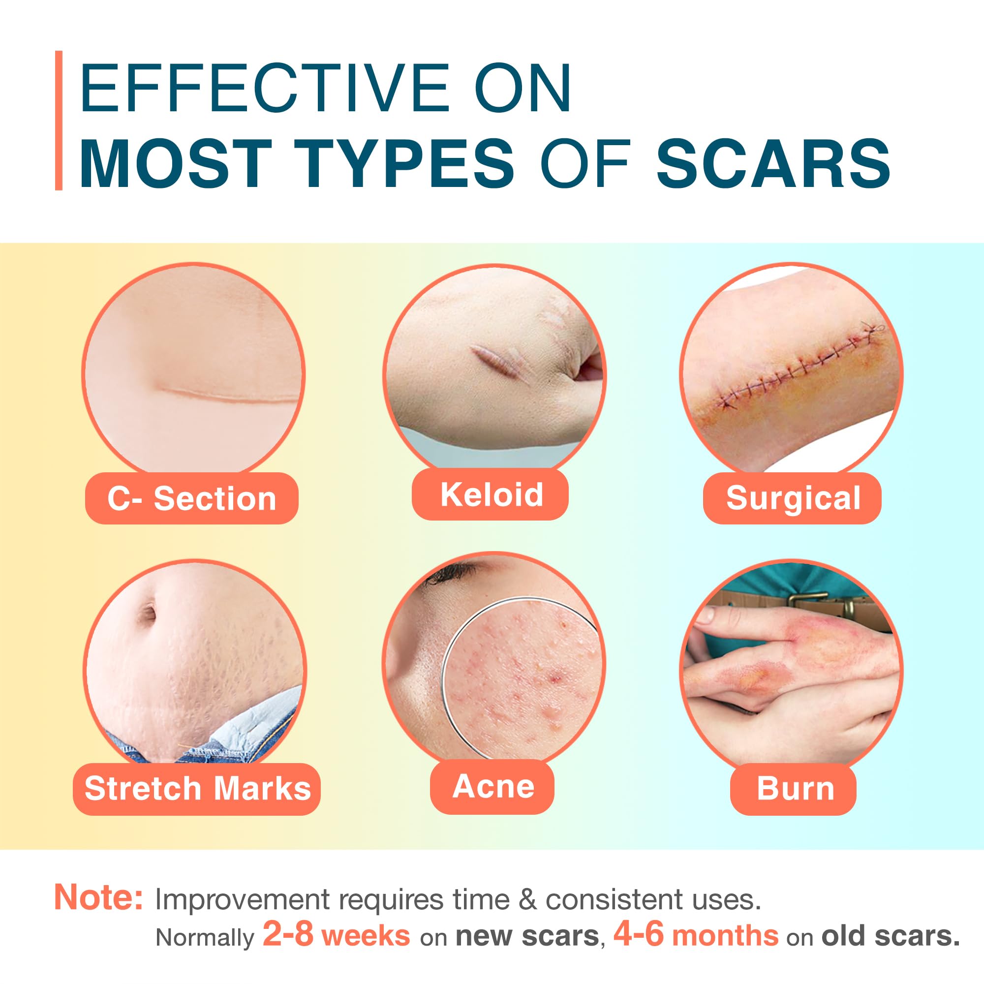 MEDLOT scar sheets cut to size along perforated lines