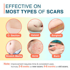 MEDLOT scar sheets cut to size along perforated lines