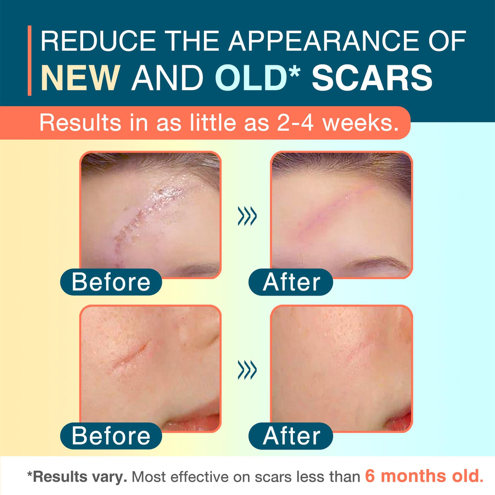 MEDLOT silicone scar sheets being applied to skin for scar care