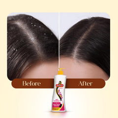 Meera anti-dandruff shampoo packaging flatlay highlighting size and features.