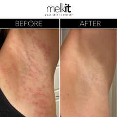 Melkit Bodymelk cream texture swirls indicate fast absorption and non-greasy feel.