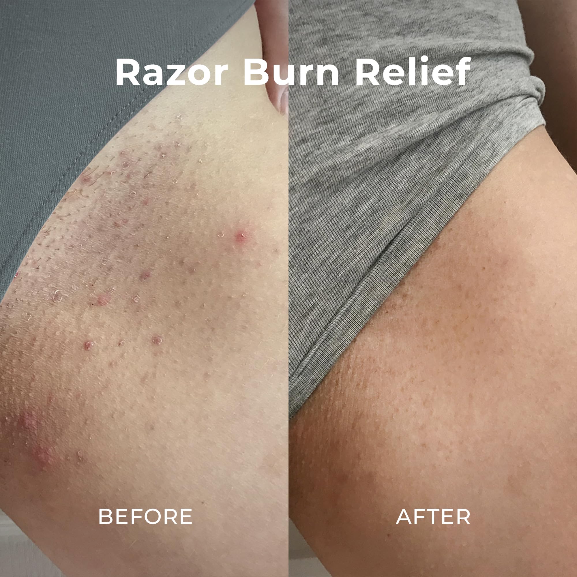 Miami Beach Bum Bum and Body Butter helps maintain skin balance.