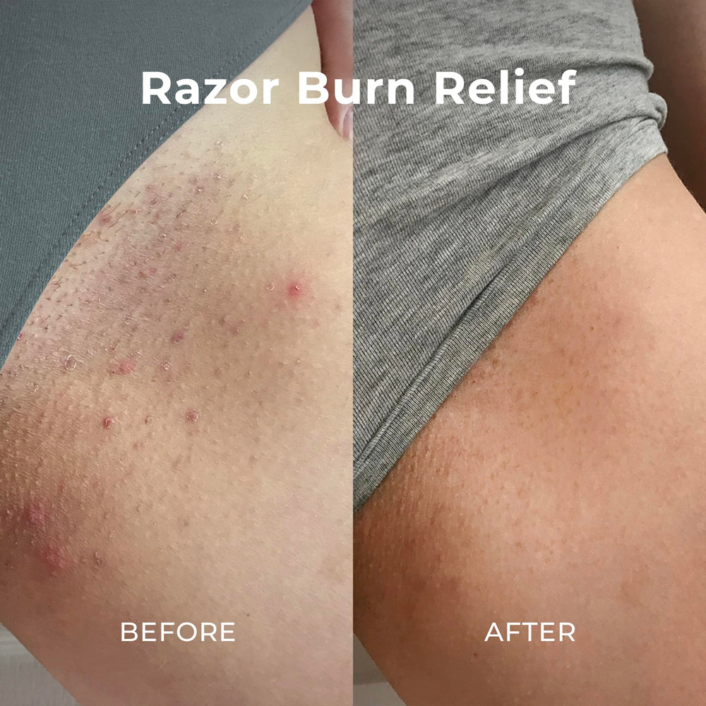 Miami Beach Bum Bum and Body Butter helps maintain skin balance.