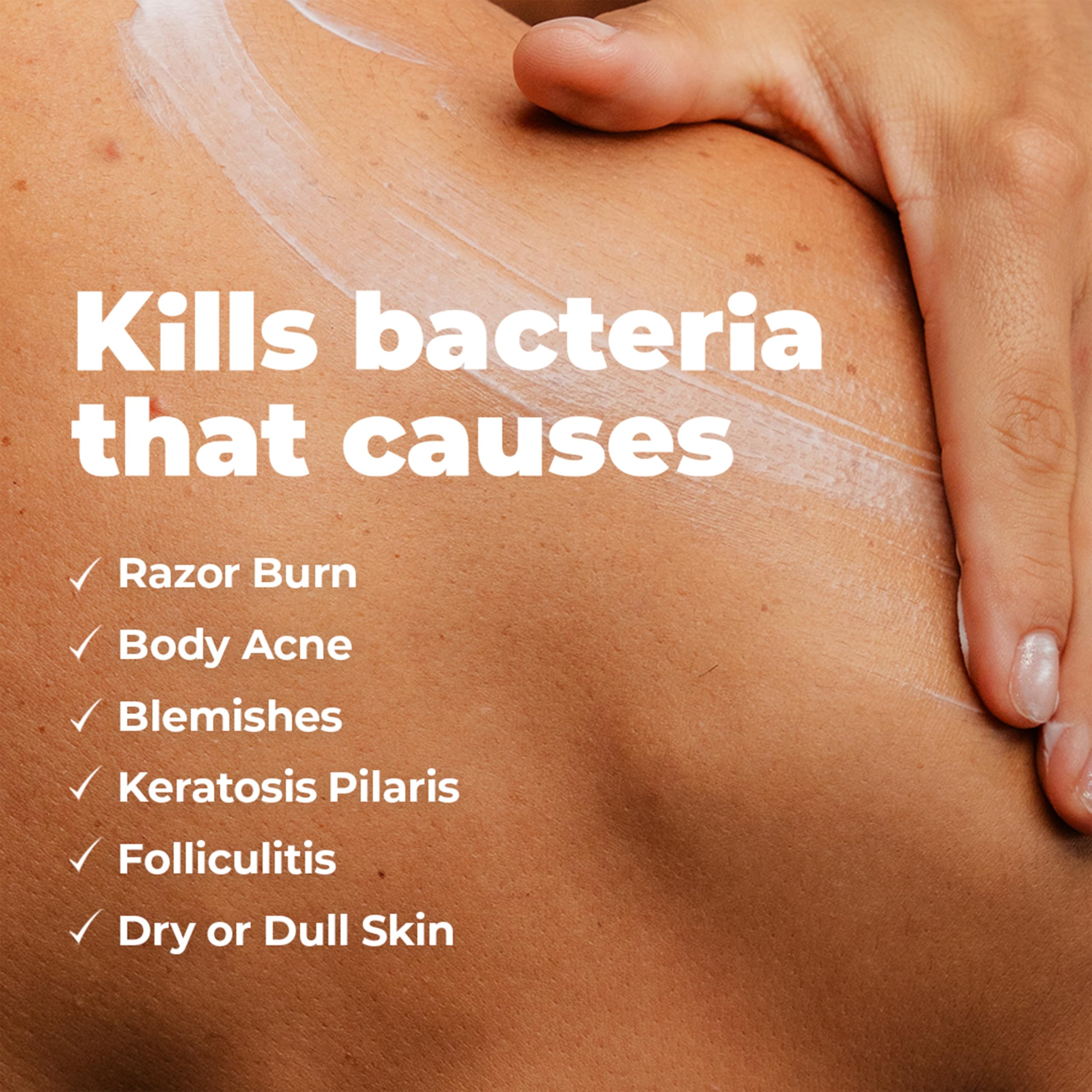 Miami Beach Bum Bum and Body Butter spot treatment on irritated skin.