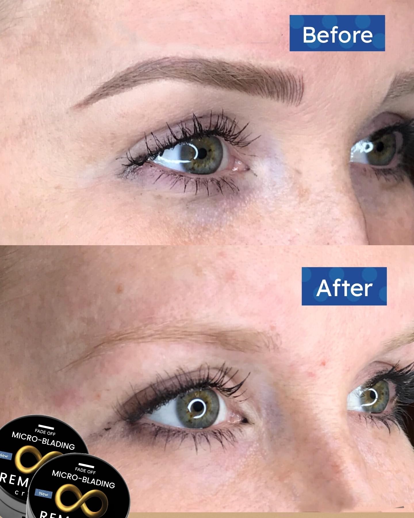 Microblading Removal Cream bottle pour showing easy application for brow pigment fade.