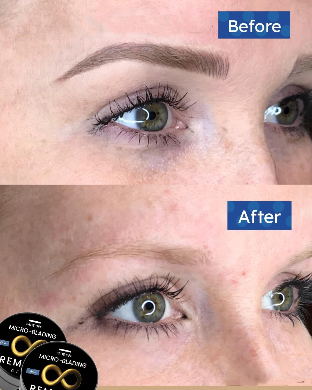 Microblading Removal Cream bottle pour showing easy application for brow pigment fade.