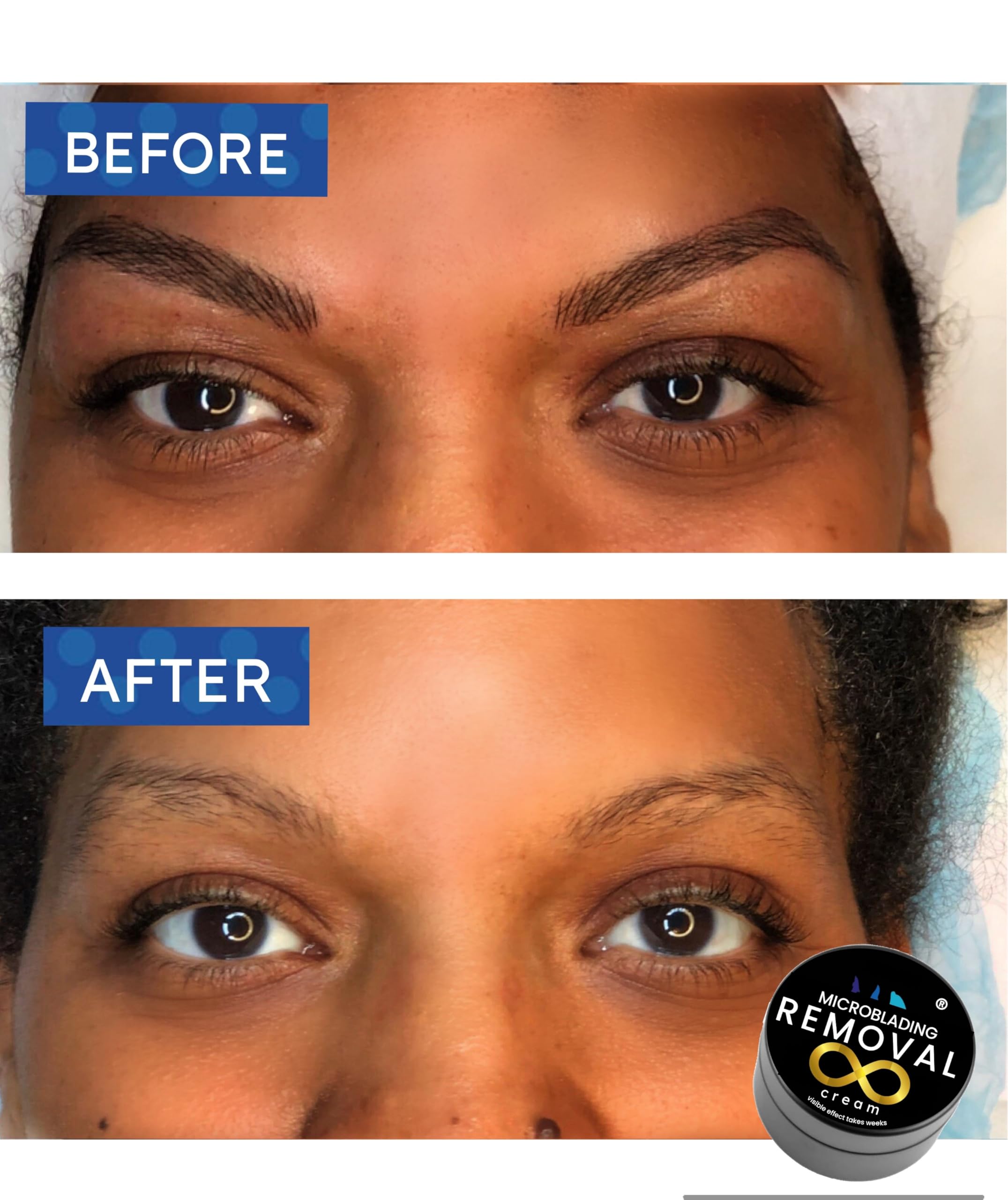Microblading Removal Cream creamy texture ready for smooth blending and even tone.