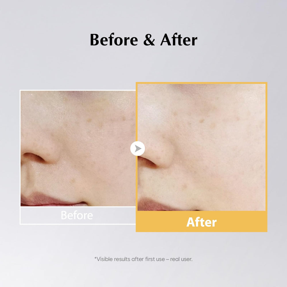Midha Rice Mask pore-clearing effect shown after application.